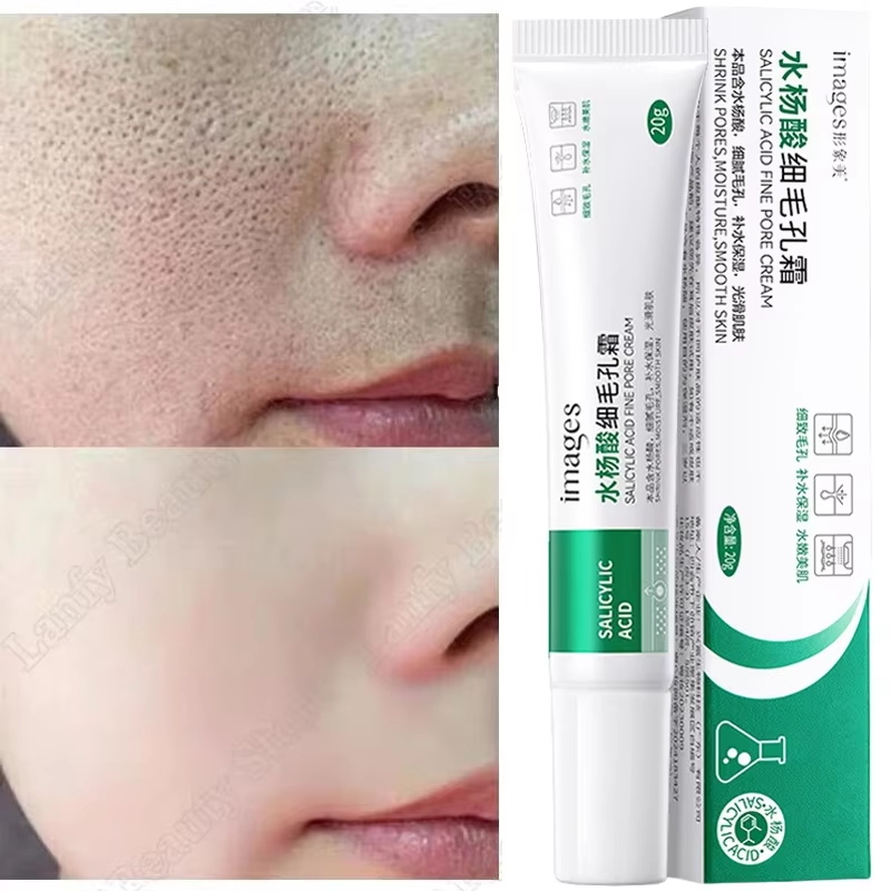 Krem z kwasem salicylowym do o – Salicylic Acid Blackhead Remover recenzja i cena